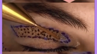 مراحل جراحی پلک چیست؟