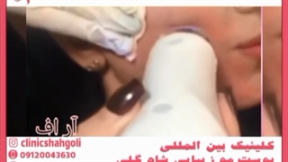 هایفو تراپی بهتر است و یا لیفت صورت؟ ابرسانی پوست