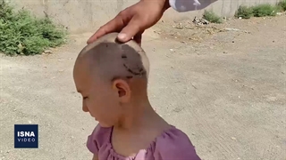 جولان سگ‌های ولگرد در دام‌شهر قم؛ جان کودکان در خطر است