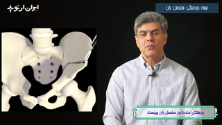 دررفتگی مادرزادی لگن