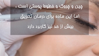 بوتاکس زیربغل - کف دست و کف پا