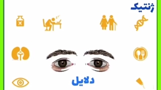 دلیل پف چشم چیست؟