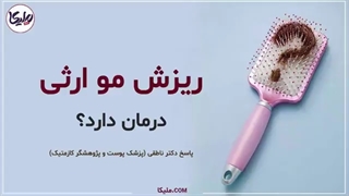 درمان ریزش مو ارثی