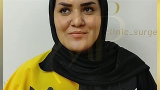 نتیجه لیپومتیک غبغب بعد از 20 روز- کلینیک vip تهران