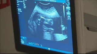 سونوگرافی تشخیصی پزشکی