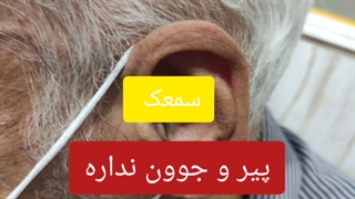 سمعک خانم ها