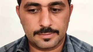 کاشت مو