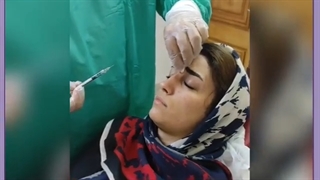 تزریق ژل و یا چربی برای اصلاح قوز بینی برداشتن زگیل