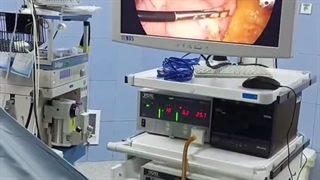 بازگشت وزن در بالون معده