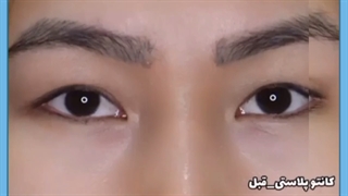 بهترین طرح های لیفت مژه توسط دکتر علیزاده