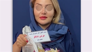 رضایت زیباجوی عزیز از جراحی های زیبایی