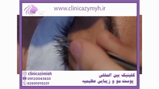 همه چیز در باره لیفت و لمینت