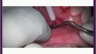 آشنایی با انواع جراحی دهان و دندان در کلینیک الهیه تهران