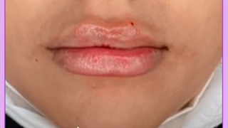 ماندگاری ژل لب چقدر است؟