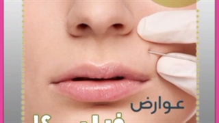 همه چیز در خصوص فیلر لب عوارض مزایا