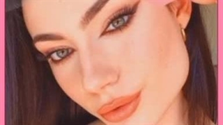 چشم روباهی طبیعی چه ویژگی های دارد؟