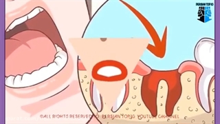 درد دندان چیست و چگونه در منزل از آن خلاص شویم؟