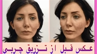 برای زیبایی صورت چه مواد غذایی بخوریم؟
