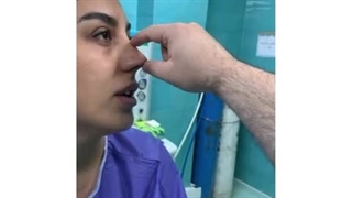 جراحی بینی نیمه فانتزی