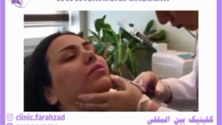 تزریق چربی چقدر ماندگاری دارد؟ لیزر فرکشنال