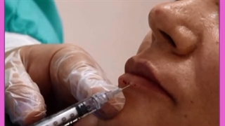 هزینه عمل زیبایی لب ها