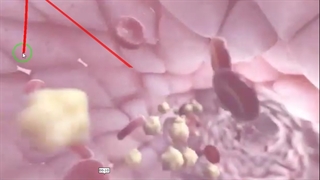 عملکرد پلاکت ها در خونریزی شدید-انعقاد خون-زیست دهم-مهدی محمد حسین زاده