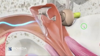 چگونگی شنیدن صدا-حس شنوایی-زیست یازدهم-مهدی محمد حسین زاده