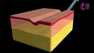 معرفی فیلر الانسه هلند - گروه بازرگانی نیکطب