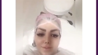 تعداد جلسات مورد نیاز آر اف فرکشنال ؟