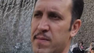 کاشت مو