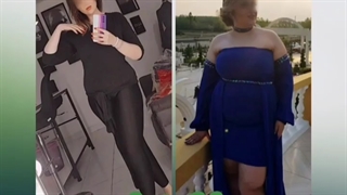 قبل و بعد عمل اسلیو