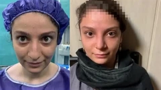 جراحی بینی مدل طبیعی