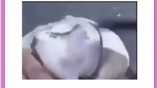 استفاده از دندان مصنوعی