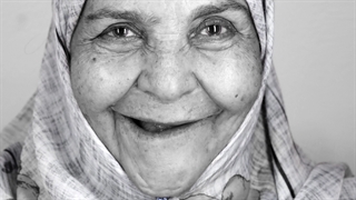 ایمپلنت فول فک