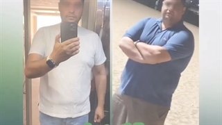 قبل و بعد عمل چاقی