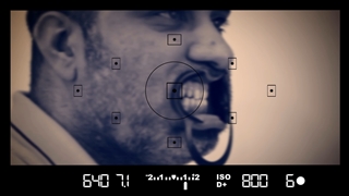 تعویض کامپوزیت با لمینت دندان در مشهد | کلینیک دندانپزشکی بارانا