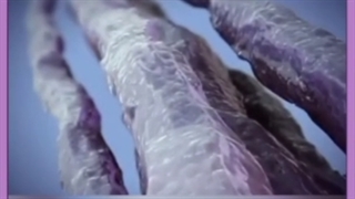 قیمت دستگاه هایفو چقدر است ؟