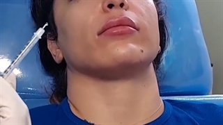 مراقبت های بعد از تزریق ژل و بوتاکس ماموپلاستی