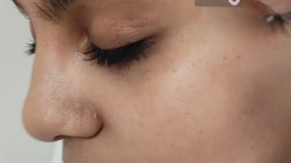 فیشیال صورت - کلینک زیبایی آنا لیفت ابرو