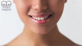 سفید کردن دندان ها با کامپوزیت