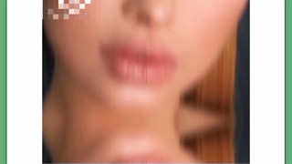 دوره نقاهت هایفوتراپی چقدر است؟