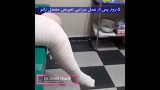 پنج روز پس از تعویض مفصل زانو