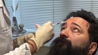 بوتاکس پیشانی (کلینیک زیبایی استار بیوتی )