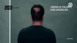 رفع کم پشتی مو با اسپری تاپیک لوییس بین