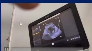 تشخیص  جنسیت جنین از روی عکس و فیلم های ارسالی شما