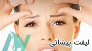 لیفت پیشانی چه زمانی توصیه می شود