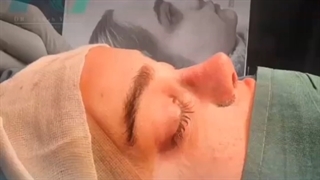 رینوپلاستی-دکتر اصحاب یمین