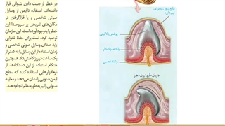 موسسه مشاوره کنکورآرت اراک-تدریس زیست یازدهم-جلسه 22 -(گیرنده تعادلی گوش)-امین فراهانی