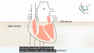 آریتمی چیست و چگونه درمان می شود؟