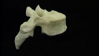 استخوان‌ها، رباطها و مفاصل ستون فقرات آکلند دوبله فارسی